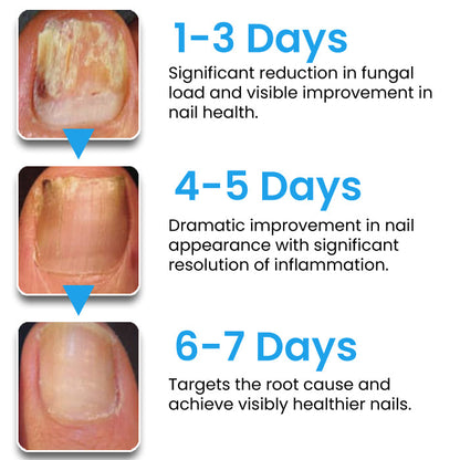🌟 Official Store | 🛡️ Clear Nails in Just 5 Days! AEXZR® NanoFix Repair Pen
