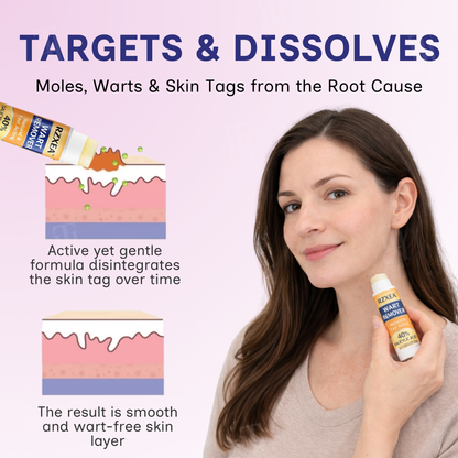 🌟 Official Store | 🛡️ The 'Glue Stick' Secret to Clear Skin! RZXEA™ Solid-Stick Wart Remover.
