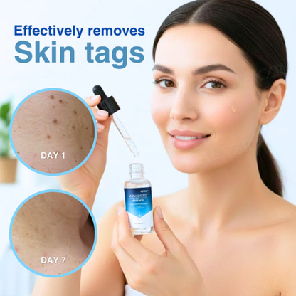 🌟 Official Store | 🛡️ No Cutting, No Scars! #1 Dermatologist Recommended. RZXEA™ Advanced Essence