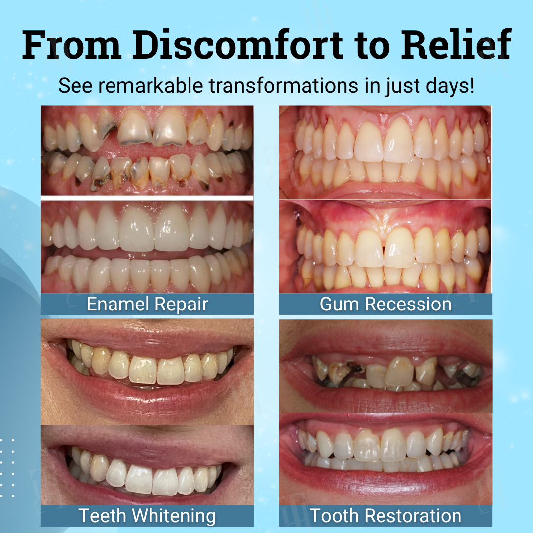 🌟 Official Store | 🛡️ Save Your Teeth Without Surgery!AEXZR® Non-Surgical Gum "Suture" Gel