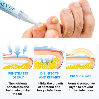 🌟 Official Store | 🛡️ Clear Nails in Just 5 Days! AEXZR® NanoFix Repair Pen