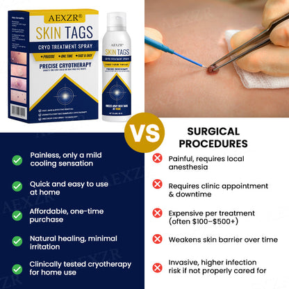 ❄️ Freeze Blemishes Instantly! | ⏱️ Flawless in Days! | AEXZR® Skin Tag Cryo Treatment Spray