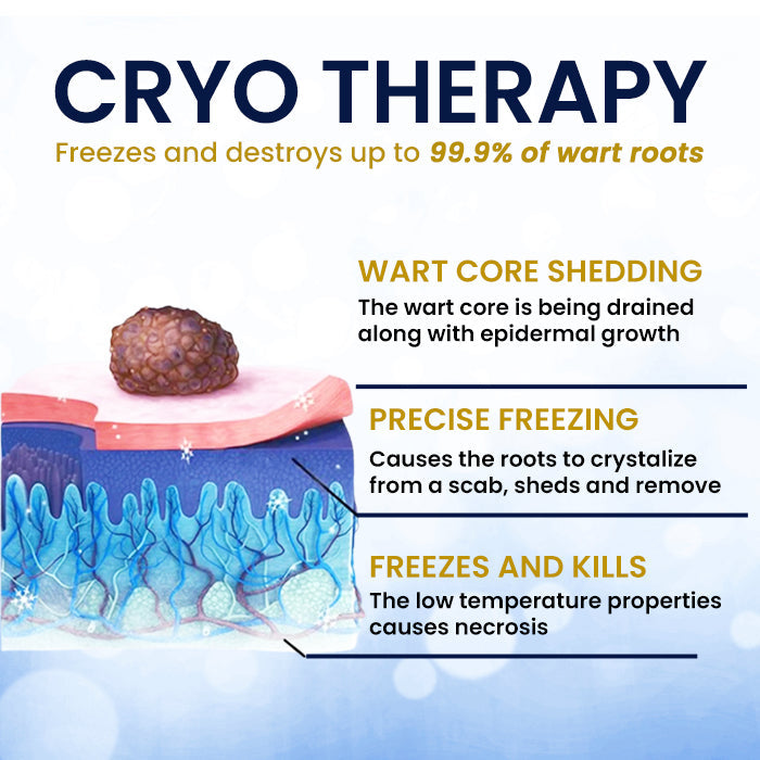 ❄️ Freeze Blemishes Instantly! | ⏱️ Flawless in Days! | AEXZR® Skin Tag Cryo Treatment Spray