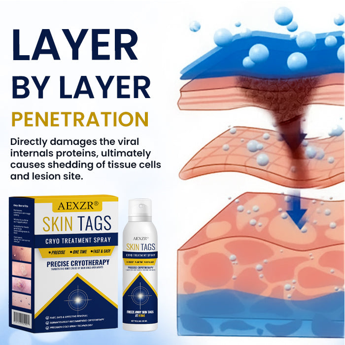 ❄️ Freeze Blemishes Instantly! | ⏱️ Flawless in Days! | AEXZR® Skin Tag Cryo Treatment Spray