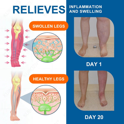 AEXZR® Advanced Lymphatic Drainage Massage Cream - Fast Relief for Swelling, Edema & Leg Heaviness - Natural Herbal Formula for Body Detox & Circulation Support 🌿✨