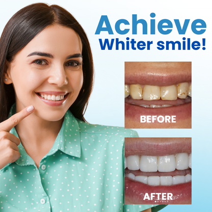 🌟 Official Store | 🛡️ Rebuild Enamel With Postbiotics Science! AEXZR® Anti-Plaque Oral Serum